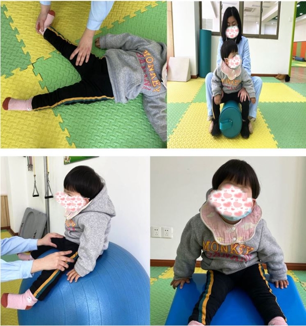 科普工作委员会脑瘫宝宝w型坐姿千万要不得